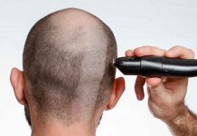 I AM GOING BALD TO FEED THE HUNGER