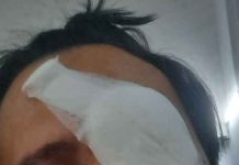 USJ2 Resident Almost Loses One Eye in “Flying Stone” Incident