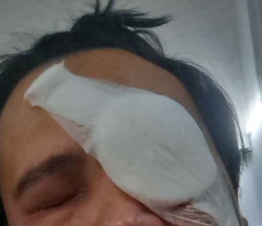 USJ2 Resident Almost Loses One Eye in “Flying Stone” Incident