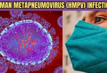 HMPV A COMMON SEASONAL RECURRENCE, NO PUBLIC ALARM NEEDS